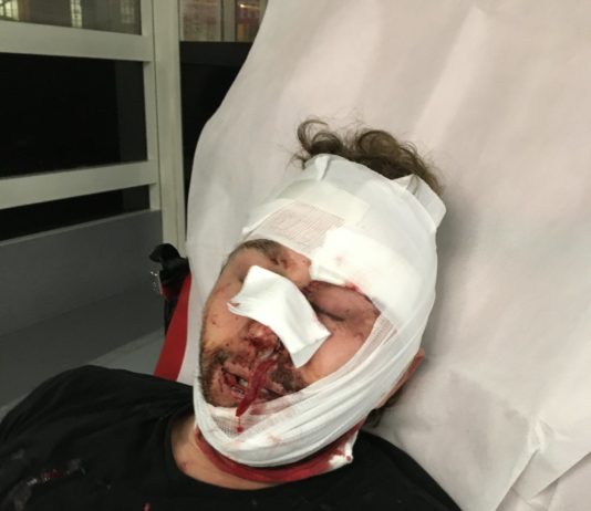 Gesetz zur „globalen Sicherheit“: Ein Fotograf in Paris verletzt – RSF prangert „Polizeigewalt“ an. Gabrielle Cezard, AFP