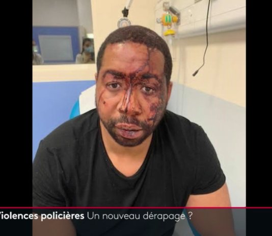 Polizeibrutalität: Ein Mann von Beamten verprügelt