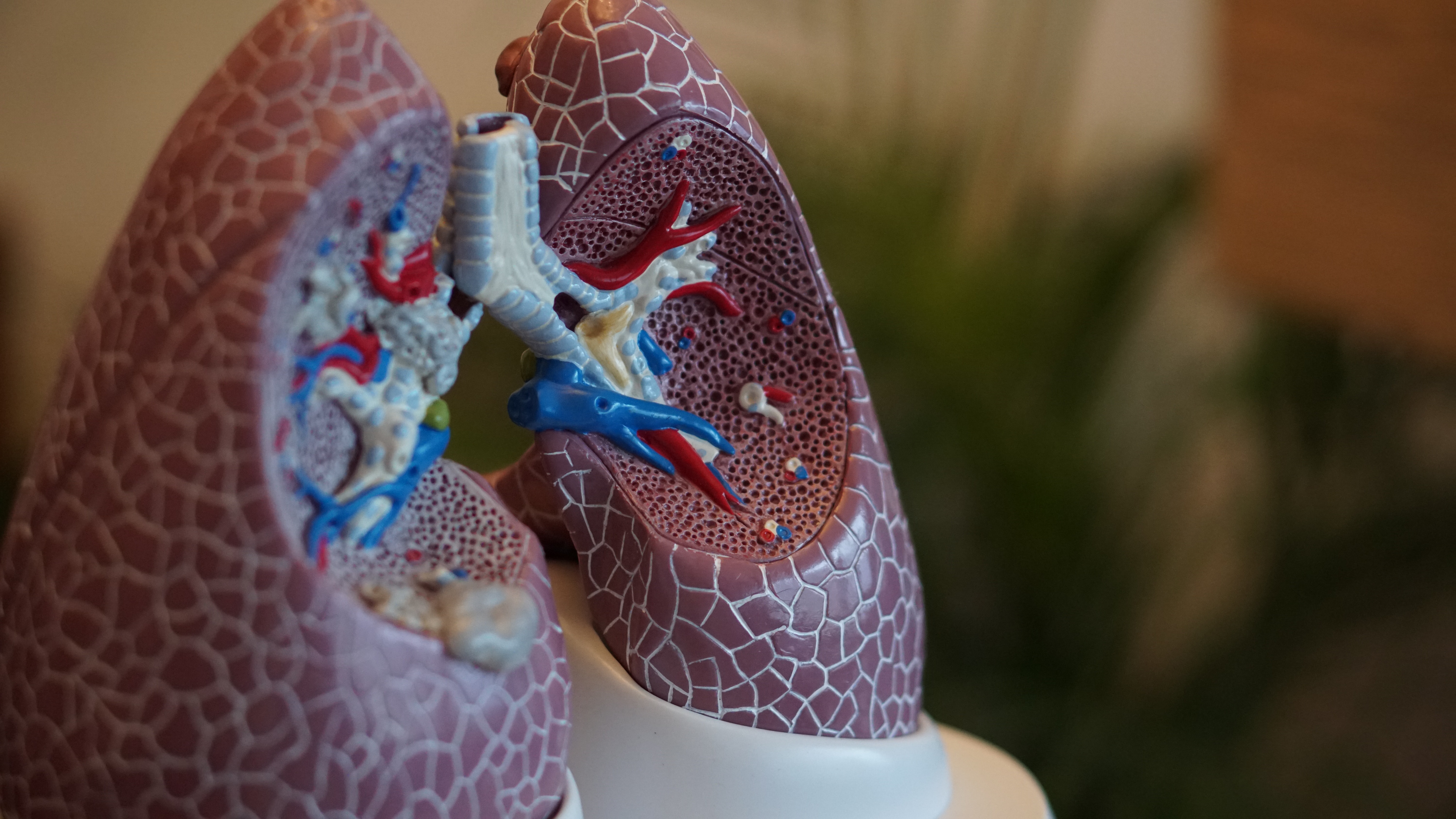 Covid-19: Lungentransplantation