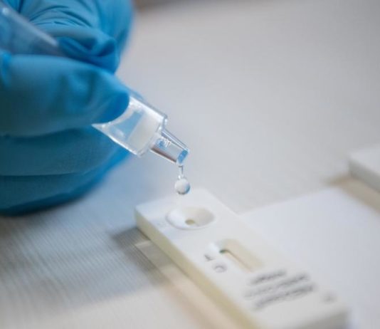 Covid-19: Die britische Variante kann in zwei bis drei Monaten Frankreich dominieren