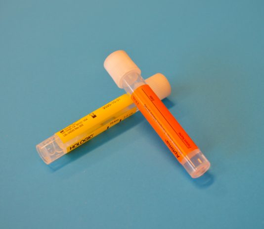 Covid-19: Verkauf von Urin-Selbsttests in Frankreich verboten