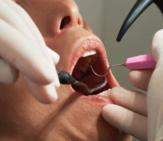 Yvelines: Luxusuhr am Handgelenk, Millionenschaden in der Bilanz – Wie vier Zahnärzte und ein Buchhalter ins Visier der Justiz gerieten Zahnarzt