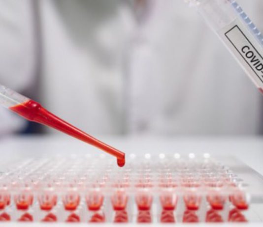 Delta-Variante: Fünf Fragen zu dieser gefährlichen Mutation des Coronavirus