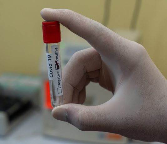 Covid-19: PCR-Tests für ausländische Touristen werden kostenpflichtig und damit kommen falsche Zertifikate auf den Markt