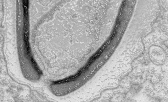 Aus der Wissenschaft: Prähistorische Viren beunruhigen die Forscher