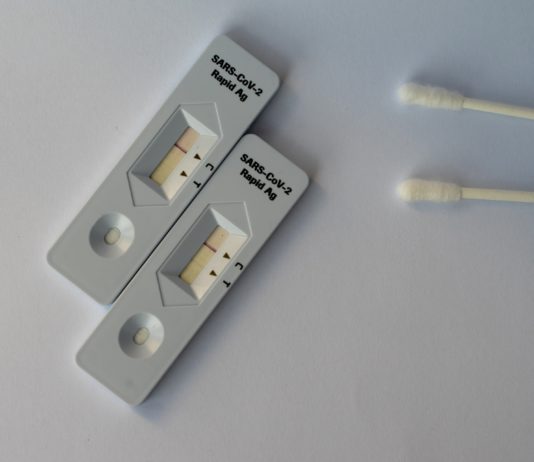 Covid-19: Kann man sich von der Arbeit freistellen lassen, um sich oder seine Kinder testen zu lassen?