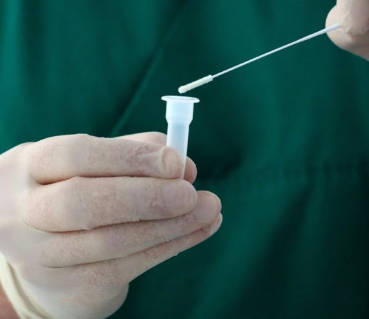 Covid-19: Bleiben die Tests für Ungeimpfte nach dem 14. März kostenpflichtig?