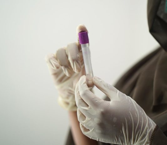 Affenpocken: 780 neue Fälle in 27 weiteren Ländern