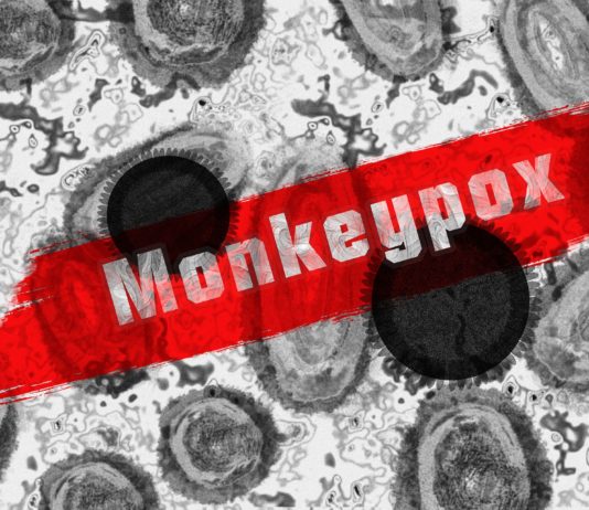 Affenpocken: Jetzt 16 bestätigte Fälle in Frankreich