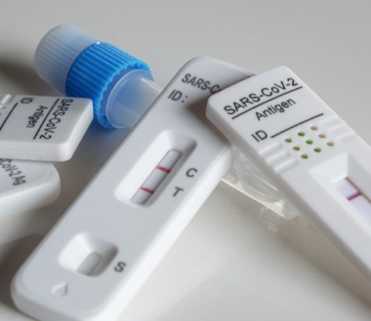 Frankreich: Covid-19-Tests werden nicht mehr systematisch erstattet Covid-Test