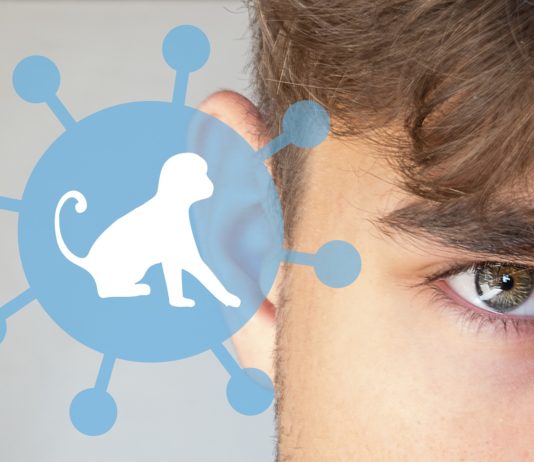 Affenpocken: In Frankreich breitet sich die Krankheit aus Affenpocken