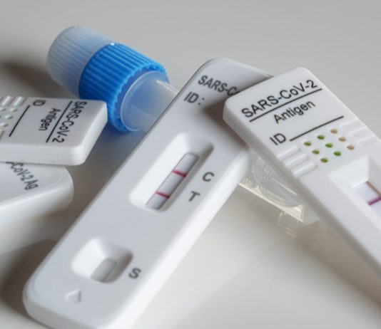 Covid-19: Viruszirkulation beschleunigt sich und Santé publique France ruft zur Einhaltung von Barrieregesten auf Antigentest
