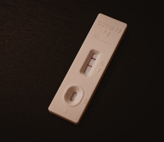 Covid-19: Die 8. Welle in Frankreich kündigt sich an covid-19-test