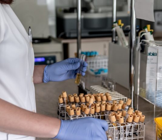 Private medizinische Labore in Frankreich streiken ab Montag für drei Tage medizinisches_Labor