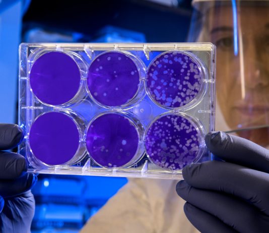 Antibiotika am Limit: Wie resistente Bakterien zur globalen Gefahr werden Bakterien_Wissenschaft_Labor