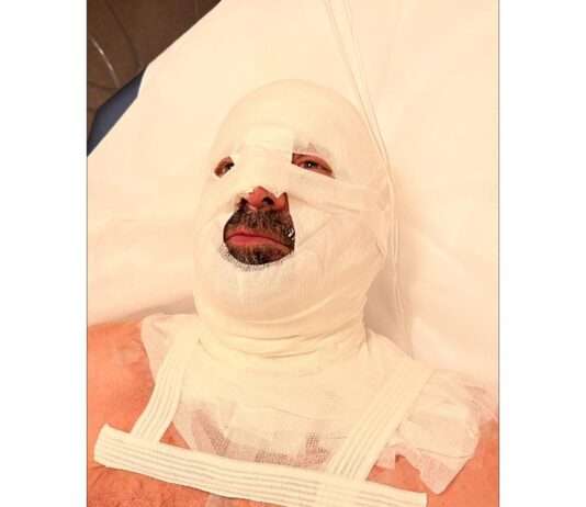 „À quoi bon se donner autant ?“ – Der Unfall eines Dorfbürgermeisters, der Frankreich bewegt Olivier_Bureaux_ScreenFB