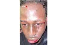 „Mitten ins Gesicht“ – Der Fall Aly Saounera und das fragile Vertrauen in die Polizei Aly_Saounera_ScreenX