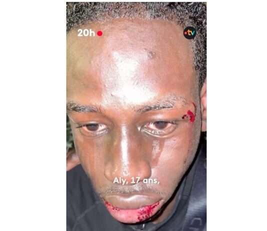 „Mitten ins Gesicht“ – Der Fall Aly Saounera und das fragile Vertrauen in die Polizei Aly_Saounera_ScreenX