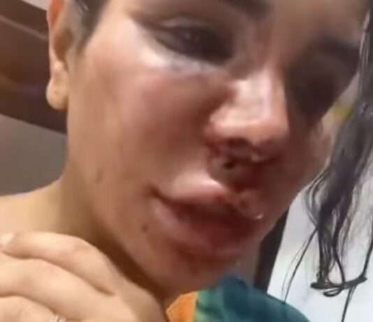 „Ich wurde gefesselt, geschlagen, entstellt“ – Der brutale Überfall auf Soraya Riffy und die Schattenseiten des Influencer-Daseins Soraya Riffy_Snapchat_Screen