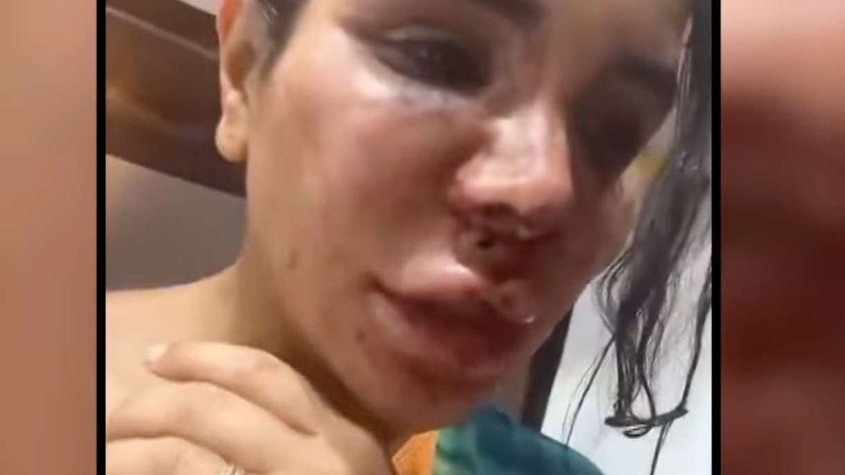 „Ich wurde gefesselt, geschlagen, entstellt“ – Der brutale Überfall auf Soraya Riffy und die Schattenseiten des Influencer-Daseins