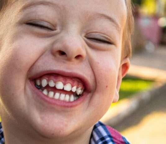 Das Lächeln einer Gesellschaft – Warum Zahngesundheit mehr als nur Kosmetik ist Zahngesundheit_Lächeln_Illustration