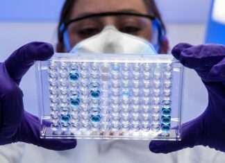 Der „Schraubenzieher-Vergewaltiger“ von Poitiers – wie moderne DNA-Fahndung ein Jahrzehnt des Schweigens durchbrach DNA_Analyse