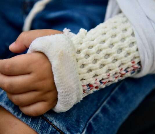 Wenn der Jahreswechsel Hände kostet – Elsass erlebt eine Nacht der Verstümmelungen Hand_Verletzung